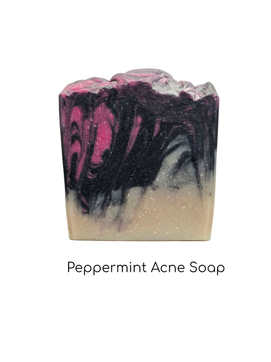 Peppermint Acne Soap